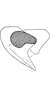 Head: Head and thorax. (Observation).
