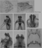 male genitalia. Depicts Melanoplus flabellatus (Scudder, 1878), an Otu.