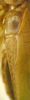 CollectionObject 1476144; 7f1c841b-e43b-4a4a-8528-5065deb643d9: male right stridulatory area, whole view (holotype). (CollectionObject).