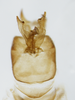 Pygofer, ventral view: !! display not done !! on Bostaera balli Penner, 1952: (Observation).