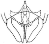 Subgenital plate: !! display not done !! on Polyamia (Copolyamia) interrupta (DeLong, 1916): genital capsule, ventrally. (Observation).