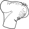 Pygofer, lateral view on Edwardsiana pseudocommissuralis Christian, 1953: Pygofer, lateral view. (Observation).