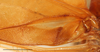 CollectionObject 1586792; b2b05d79-8dbb-4975-aa7b-8044811d7573: male, base of left tegmen, scale bar 5 mm. (CollectionObject).