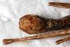 CollectionObject 1567637; 6b6d61b2-c7f3-40c6-abb2-500bf0a2454f: male abdomen tip, caudal view. (CollectionObject).