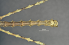 CollectionObject 1595663; 8416ac18-c066-46bd-b471-62bd83d6153c: copyright SWFU Kunming. male end of abdomen, ventral view (paratype). (CollectionObject).;CollectionObject 1595664; 2e916493-bfb1-4db4-9fc4-1ce74a5cd755: copyright SWFU Kunming. male end of abdomen, ventral view (paratype). (CollectionObject).;CollectionObject 1595665; 7cedf640-d187-4b04-b575-03190d975d63: copyright SWFU Kunming. male end of abdomen, ventral view (paratype). (CollectionObject).