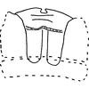 Abdomen, sternal apodemes, ventral view on Anufrievia crispata Tan, Jiang & Song, 2021: (Observation).