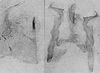 Other: Pygofer lobe, aedeagus, connective, and styli. (Observation).