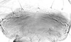 Connective.: Hairs on subgenital plate of A. pomi. (Observation).
