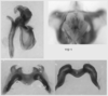 Melanoplus marshallii (Thomas, 1875): male genitalia. (Otu).