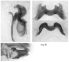 Melanoplus marshallii (Thomas, 1875): male genitalia. (Otu).