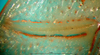 CollectionObject 1500526; 24761f4c-3a59-4dbd-b9a3-c970a3e644f6: male stridulatory file (syntype). (CollectionObject).