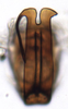Aedeagus, ventral view: Euscelis seriphidii, aedeagus, caudally (INHS). (Observation).