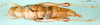 CollectionObject 1595427; 75770566-301e-45c4-ad34-7f78284900d0, DORSA BA000608S03: female, dorsal view (syntype of Symbellia stigmatica). (CollectionObject).