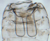 Abdomen, sternal apodemes, ventral view: (Observation).