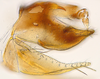 Pygofer, lateral view: (Observation).
