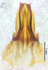 CollectionObject 1477843; a1aa5fe7-8182-4931-9db1-504a76fca5cc: male genitalia, ventral view (holotype). (CollectionObject).