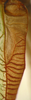 CollectionObject 1475679; ef147de6-945b-48e7-8582-95547db27a17: male left stridulatory area (holotype). (CollectionObject).