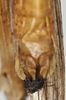 CollectionObject 1581309; c58ee664-0fde-4cda-b5db-2423f016bf9e, NHMUK10924579: female abdomen tip, ventral view. (CollectionObject).