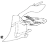 Pygofer, lateral view: (Observation).