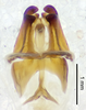 CollectionObject 1523727; c0a52703-44b5-4c30-bc31-742b6009fbae: male genitalia, dorsal view (holotype). (CollectionObject).