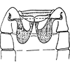 Abdomen, sternal apodemes, ventral view: !! display not done !! on Empoasca (Empoasca) ledesma Ross, 1959: Sternal apodemes. (Observation).