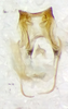 CollectionObject 1523616; cc0ef9bb-1f9c-4083-a25f-db8784b81fe0: male genitalia, ventral view (holotype). (CollectionObject).