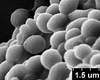 Brochosomes: !! display not done !! on Cuerna alba Oman & Beamer, 1944: CR821 | U.S.A., New Mexico Eddy Co., 26mi E Carlsbad | 5/24/1977 | TAMU. (Observation).