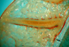 CollectionObject 1502911; e4e58ae3-53e9-41a3-a94a-44dc3106dab6: male stridulatory file (from different specimen?). (CollectionObject).