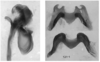 Melanoplus marshallii (Thomas, 1875): male genitalia. (Otu).