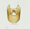Pygofer, ventral view: !! display not done !! on Toya (Metadelphax) argentinensis (Muir, 1929): (Observation).