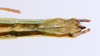 CollectionObject 1559169; f81aba32-0866-46e3-af43-75a7e99279a7: copyright ZMUH, Hamburg. female: end of abdomen, ventral view (holotype). (CollectionObject).