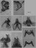 Melanoplus borealis (Fieber, 1853): male genitalia. (Otu).