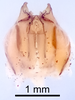 CollectionObject 1523108; b57afcf4-05fa-4197-af9d-3b5c8bcace13: Male genitalia, ventral view (holotype). (CollectionObject).