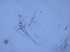 Subgenital plate: Holotype. (Observation).