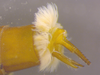 CollectionObject 1575891; INHS INHSPlecoptera15607, 638776ae-6000-45bb-8ba2-750d05b4673c: ring of filamentous gills between AB9-10. (CollectionObject).