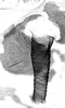 Aedeagus, lateral view.: Siphunculus (SI) of A. fabae. (Observation).