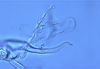 Stylus: !! display not done !! on Matsumurasca (Matsumurasca) dolonis (Oman, 1936): Holotype. (Observation).