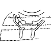 Abdomen, sternal apodemes, ventral view on Ahmedra distincta Dworakowska & Viraktamath, 1979: Sternal apodemes. (Observation).