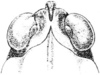 Tettigidea armata Morse, 1895: Fig. 185. female, head, dorsal view. (Otu).