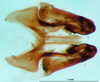 CollectionObject 1502459; 531e9e26-8bab-4b02-aa3a-339814bcab55: phallic complex, dorsal view (paralectoptype). (CollectionObject).