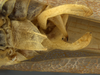 CollectionObject 1591797; 343dd7ba-4f98-46b0-bc60-cd90c6079ecf: male terminalia, ventral view. (CollectionObject).