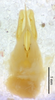 CollectionObject 1523701; 39776c6b-d87b-422a-be07-a09028b39bc9: male genitalia, ventral view (holotype). (CollectionObject).