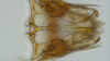 Subgenital plate: (Observation).