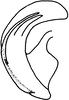 Aedeagus, lateral view on Platymetopius (Platymetopius) infectoriae Abdul-Nour, 1987: (Observation).