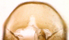 Other on Chilenana chilena DeLong & Freytag, 1967: Male [DZRJ]: valve, ventral view. (Observation).