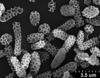 Brochosomes: CR790 cf. kaloostiani | U.S.A., Colorado, Eagle Co., Vail, R. Rakitov [#05-44], 18 May 2005 | INHS. (Observation).