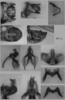 Melanoplus borealis (Fieber, 1853): male genitalia. (Otu).