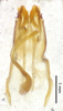 CollectionObject 1477623; ffbb23c7-dee5-4ea0-ba2b-6d9fe06574be, ANSP1116: male genitalia, ventral view (holotype). (CollectionObject).