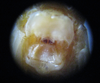 Oecanthus symesi Collins & van Den Berghe, 2014: metanotal gland. (Otu).