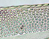 Ovipositor: Icaia laoroya, 1st valvula sculpturing (INHS). (Observation).